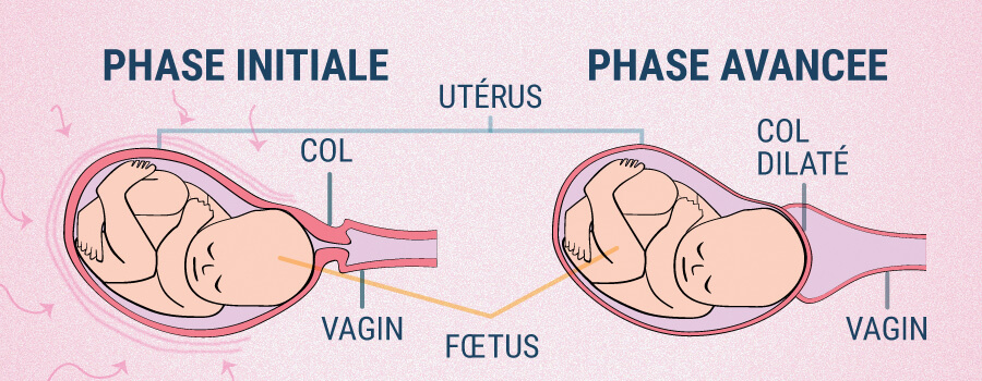 Contractions Utérines Et Cbd Contractions Utérines Et Cbd