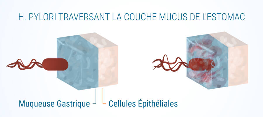 H Pylori Mucus Couche De Gastrite Gastrique Et Le Cannabis H Pylori Mucus Couche De Gastrite Gastrique Et Le Cannabis