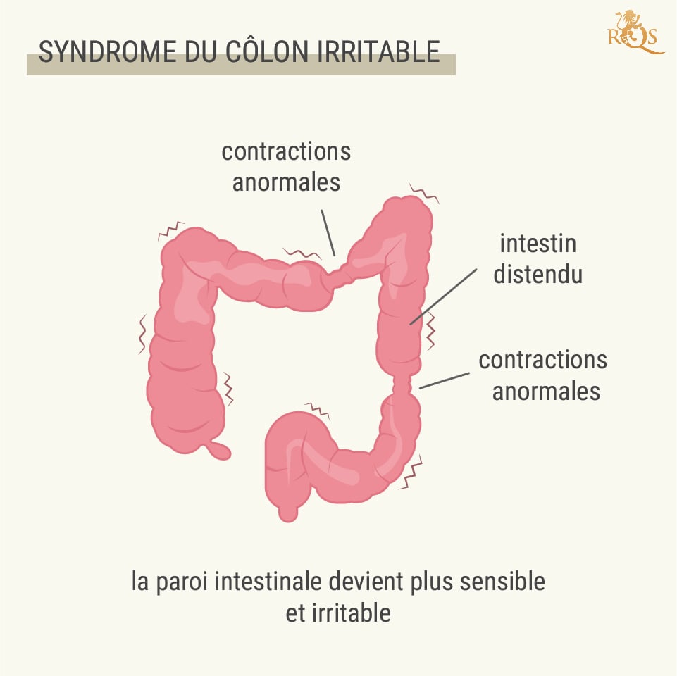 Cannabis et syndrome du côlon irritable (SCI) : la recherche - RQS ...