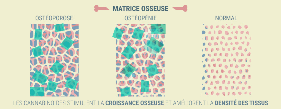 Ostéoporose CBD