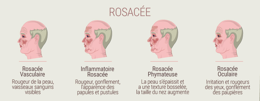 Rosacée Rosacée
