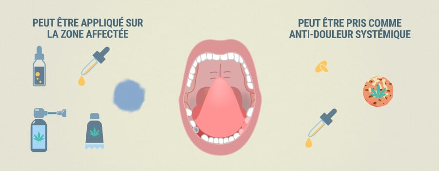 Comment La Cdb Peut Aider À Soulager Les Dents