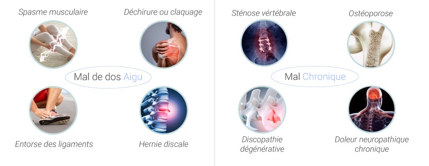 Causes communes et types de maux de dos