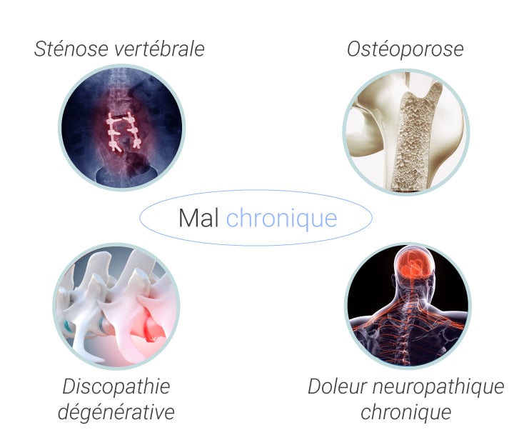 Causes communes et types de maux de dos