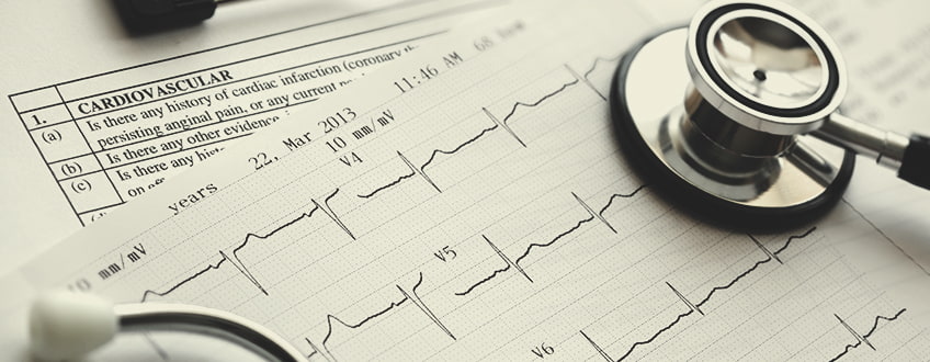 CBD et santé cardiovasculaire