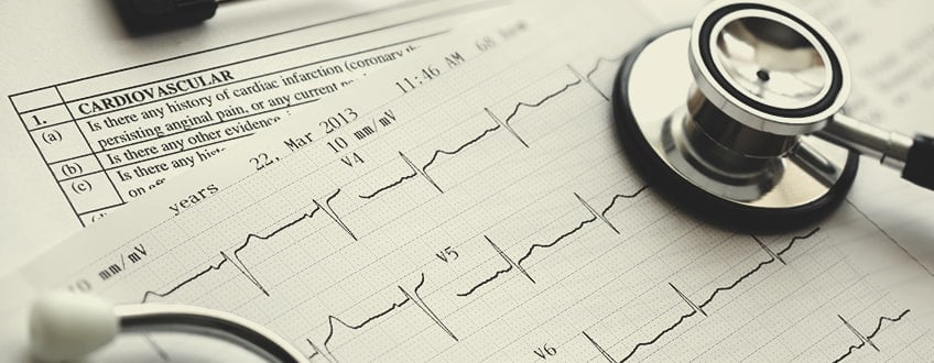 CBD et santé cardiovasculaire CBD et santé cardiovasculaire