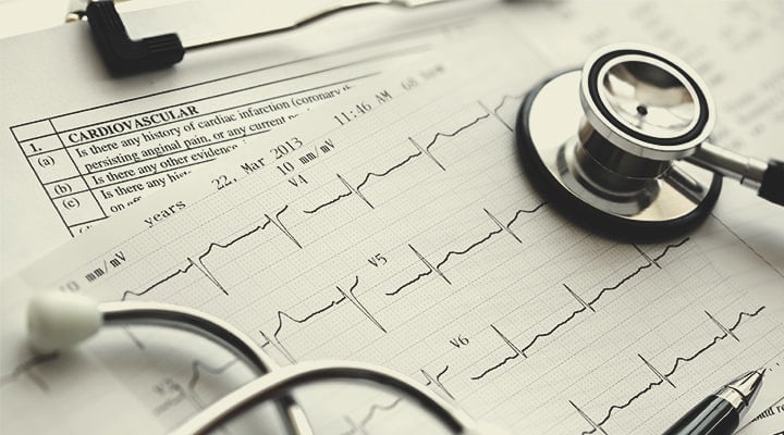 CBD et santé cardiovasculaire CBD et santé cardiovasculaire