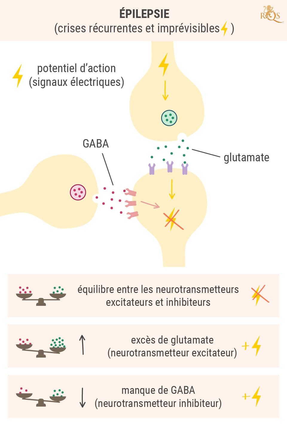 La science derrière les crises d’épilepsie La science derrière les crises d’épilepsie