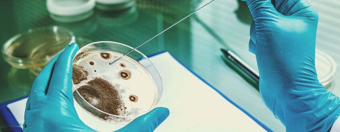 Comment les microbes se transmettent Comment les microbes se transmettent
