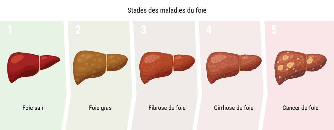 Le cannabis affecte-t-il le foie ?