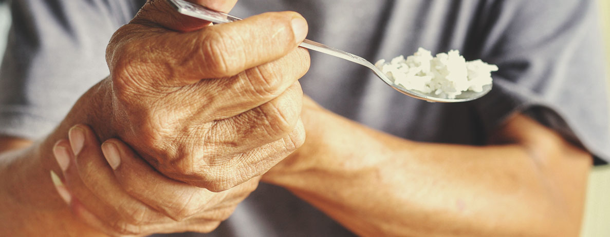 Comment la maladie de Parkinson affecte le corps Comment la maladie de Parkinson affecte le corps