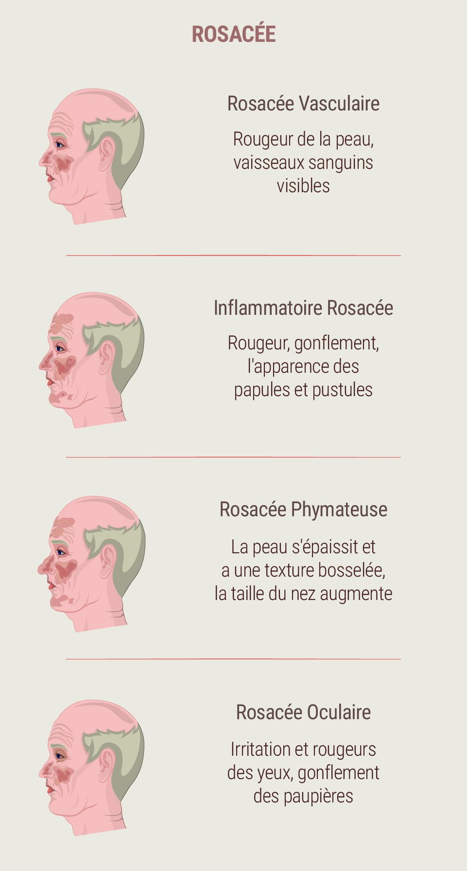 Qu’est-ce que la rosacée ? Qu’est-ce que la rosacée ?