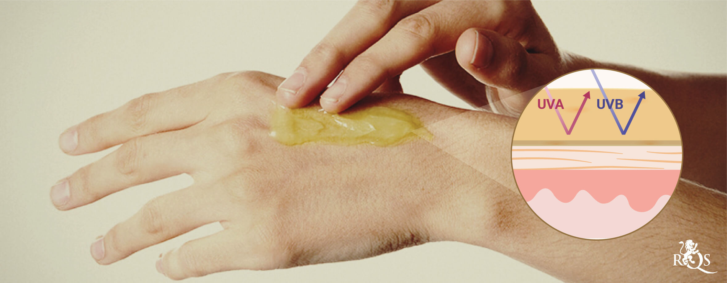 Les Lotions Au CBD Aident-Elles Contre Les Coups De Soleil ? Les Lotions Au CBD Aident-Elles Contre Les Coups De Soleil ?