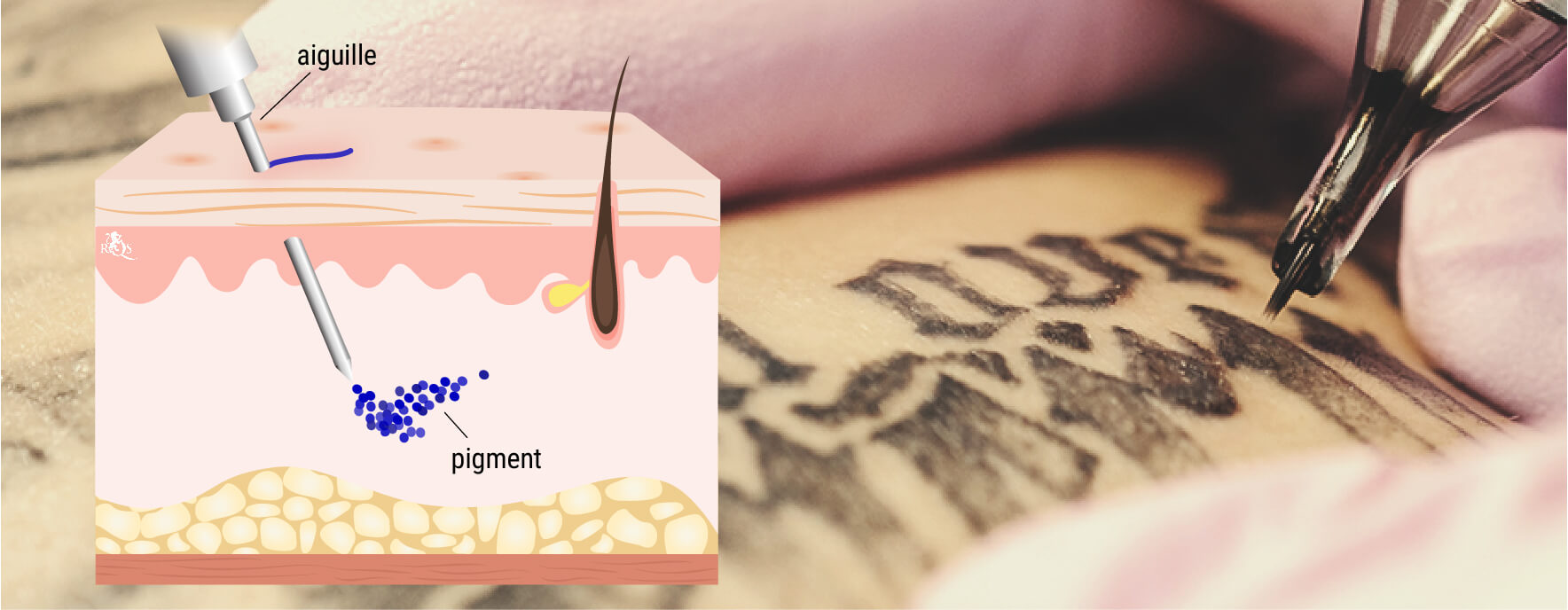 Qu’est-Ce Que Le Processus Du Tatouage ? Qu’est-Ce Que Le Processus Du Tatouage ?