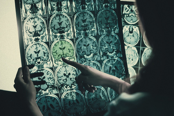 Le cannabis est-il efficace pour les personnes handicapées ?