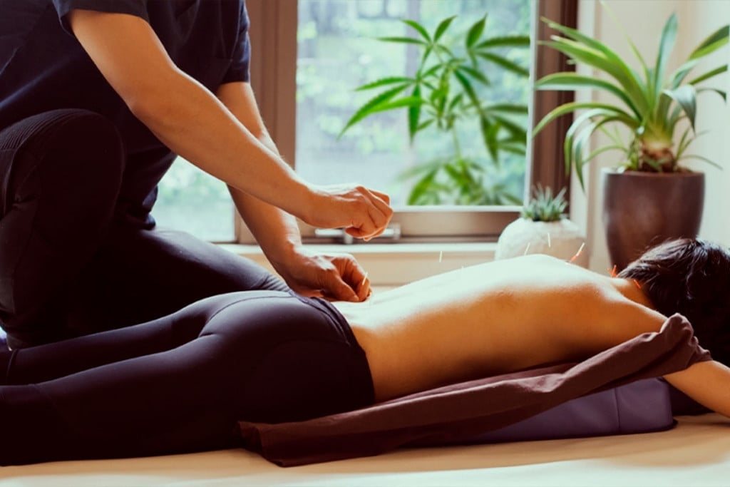 Cannabis Et Acupuncture : Double Boost Pour Le Système Endocannabinoïde
